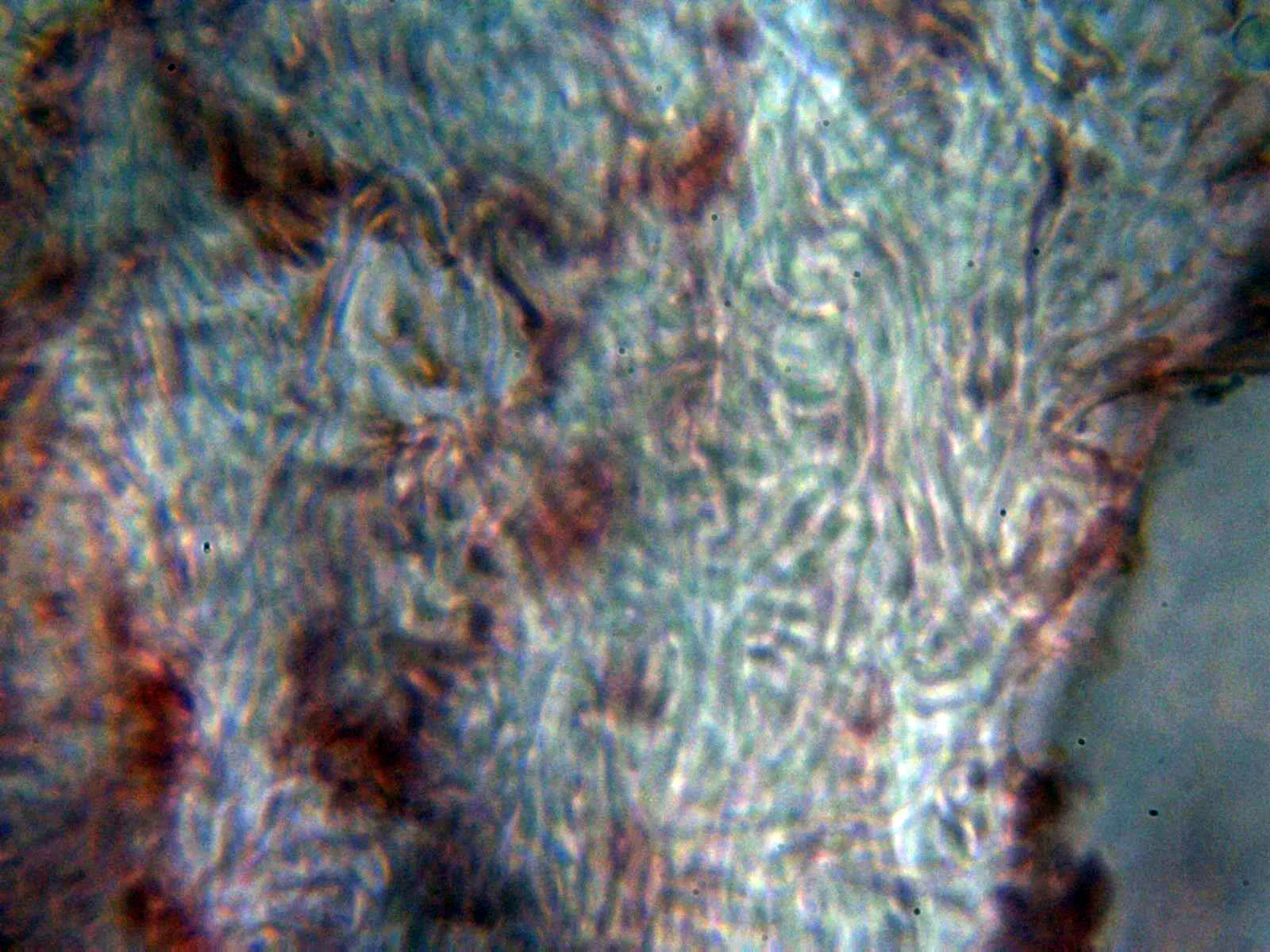 Microscopía de Tuber excavatum - 10 - Peridio interno